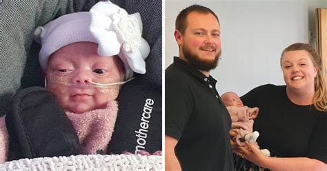Premature Baby Born At 22 Weeks Now Healthy And Safely At Home