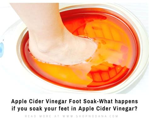 Apple Cider Vinegar Foot Soak Is One Of The Most Important Treasures Of