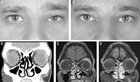 Pre And Post Operative Clinical Photographs Ct And Mri Scans A