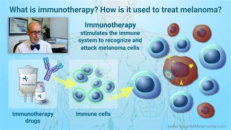 How Is Melanoma Treated With Immunotherapy Youtube