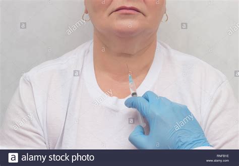 Doctor Makes A Patient Patient A Thyroid Biopsy On Suspicion Of