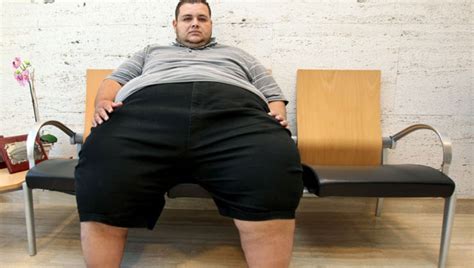 El hombre más obeso de Europa pesa kilos y va a someterse a un by pass gástrico