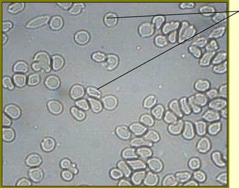 Mammalian Red Blood Cells Light Microscope X100 Download Scientific