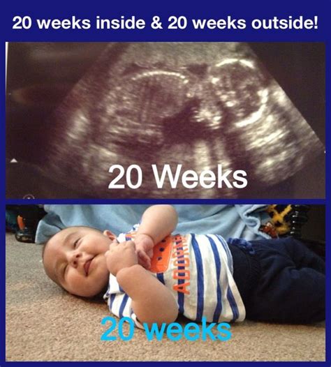 20 Weeks Inside And 20 Weeks Outside Use Ultrasound Photo And Then
