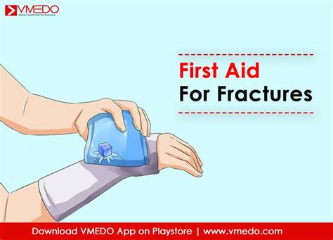 First Aid Procedure For Fracture The Y Guide