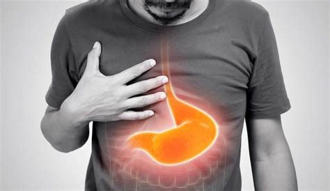Severe Heartburn Symptoms Causes Risk Factors And Treatment