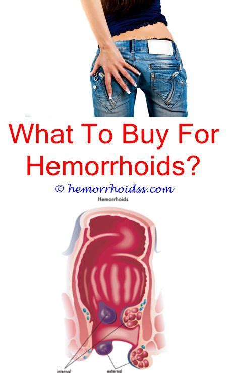 Hemorrhoids Comprehensive Introduction Covers Signs Triggers As Well