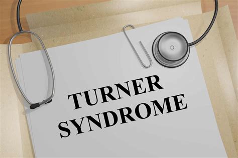 Turner Syndrome Cause Symptoms And Treatment Digital Health Buzz