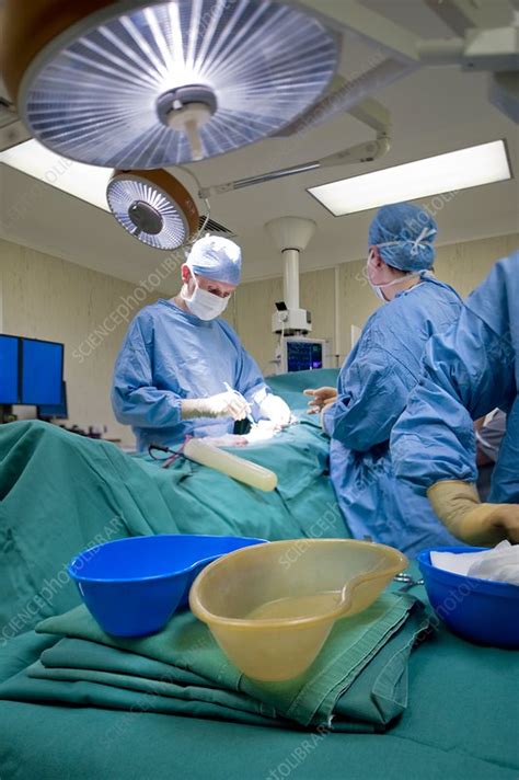 Hernia Operation Stock Image C0010900 Science Photo Library