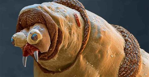 12 Things Youll Wish Youd Never Seen Under A Microscope