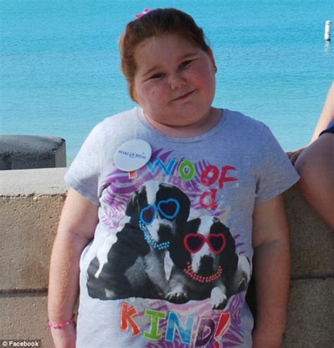12 Year Old To Receive Life Saving Gastric Bypass Surgery After Gaining