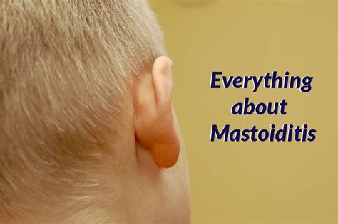 Everything About Mastoiditis Vikram Ent Hospital And Research Institute