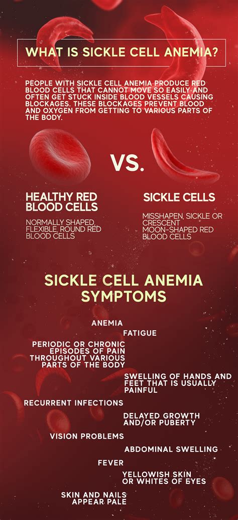 Sickle Cell Anemia Cause Symptoms And Treatment