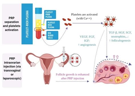Endocrines Free Full Text Ovarian Rejuvenation Using Autologous