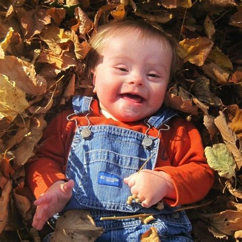 Pin On Adorable Down Syndrome Cuties