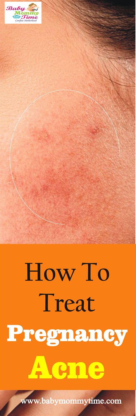 Pin on Pregnancy Care