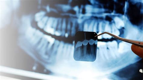 RadiologÍa Dental Aporte De La Radiología En El Diagnóstico De