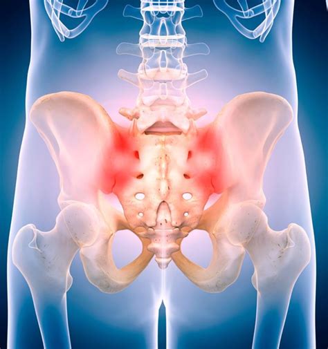 Sacroiliac Joint Injection Chalfont Pain Management Delaware Valley