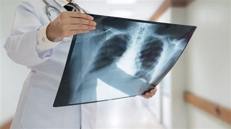 T Rax Como Fazer Diagn Sticos Atrav S Da Radiografia E Tomografia