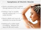 Electric Shock Symptoms Images