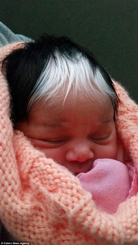 Girl Born With Striking White Streak In Her Hair And It S An Exact