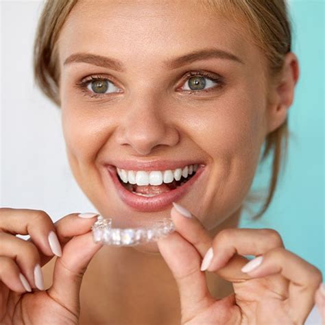 What Are Spark Clear Aligners Guidry Horaist Orthodontics