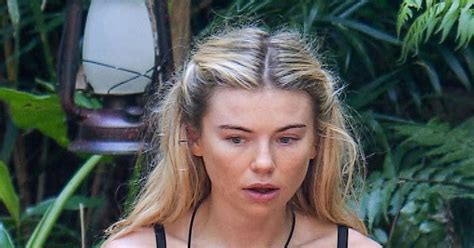 Toff Reveals Her Bizarre Word For Lady Bits During Candid Surgery