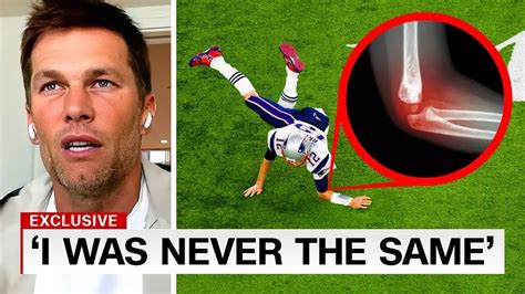 Nfls Worst Career Ending Injuries Of All Time Youtube