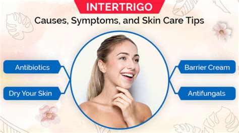 intertrigo causes symptoms and skin care tips