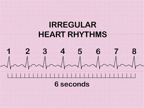 Cómo calcular la frecuencia cardiaca a partir de un ECG Wiki Salud