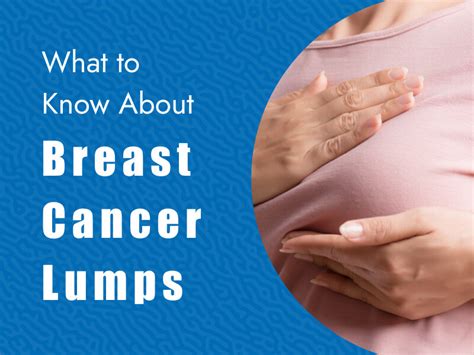 Breast Cancer Lumps How To Know If A Lump Is Breast Cancer