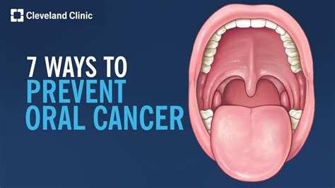 7 Ways To Prevent Oral Cancer Youtube