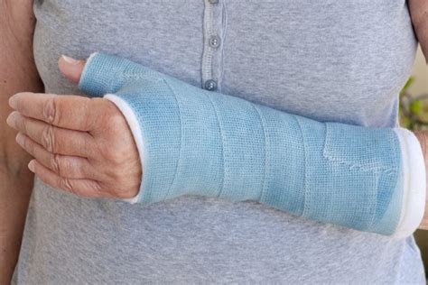 Broken Wrist Heres What You Need To Know Panorama Ortho