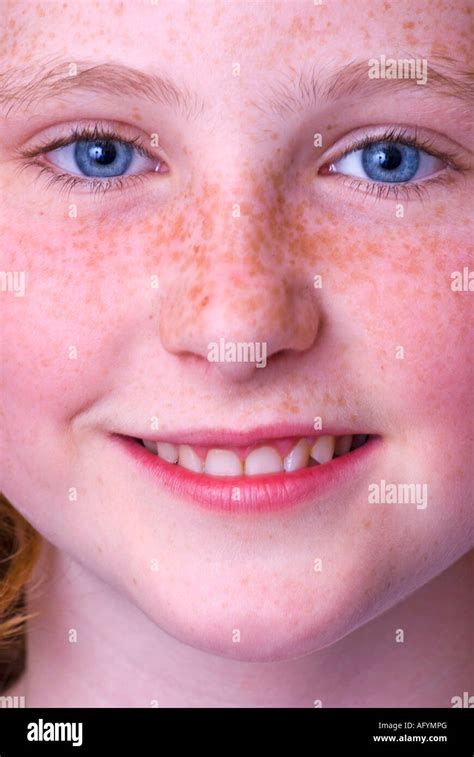 Freckle Australian Girl Hi Res Stock Photography And Images Alamy