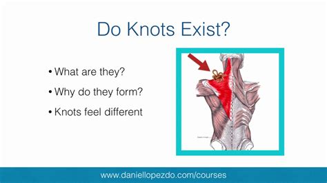 Do Muscle Knots Exist Youtube
