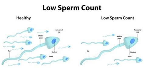How To Increase Sperm Count Foods Exercises Home Remedies