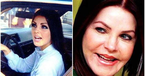 20 Celebs Who Lost Their Sex Appeal After Plastic Surgery