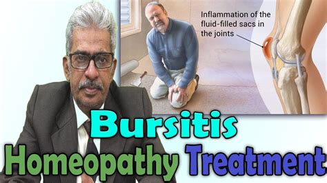 Bursitis Symptoms And Treatment In Homeopathy By Dr Ps Tiwari Youtube