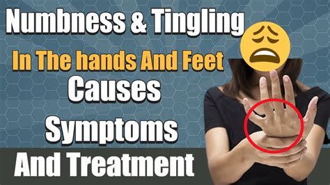 Numbness In Hands And Feet Causes And Treatment For Numbness