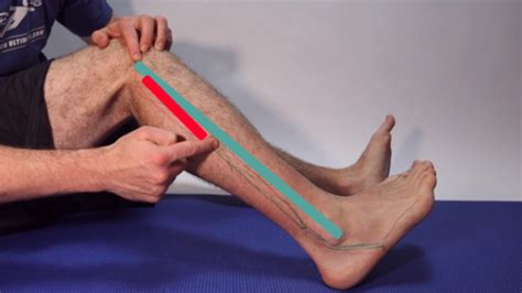 How To Instantly Fix Cuboid Syndrome 2020 Outside Of The Foot Pain