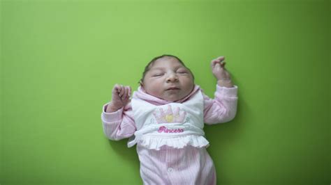 Zika Study Estimates Microcephaly Risk For Newborns