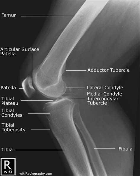 Knee Non Trauma Radiographic Anatomy Wikiradiography