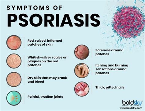 Biologics What Are They And How They Help Treat Psoriasis Treat