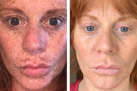 This Dark Spot Serum Has Changed The Lives Of Over 4000