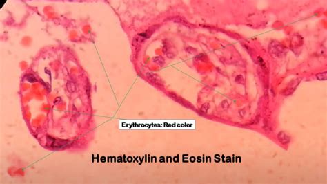 Hematoxylin And Eosin Stain Introduction Principle Procedure Result