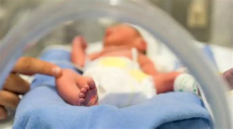 Premature Birth Increases Risk Of Chronic Kidney Disease Later In Life