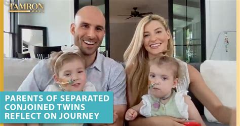 Parents Of Separated Conjoined Twins Reflect On Their Miraculous