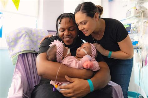 Conjoined Twin Sisters Undergo Successful Surgery To Separate At 4 Months Old Over View Your