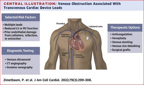 Superior Vena Cava Syndrome In Children