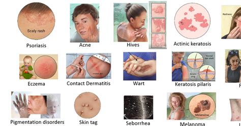 Dermatology Terms Quiz By Steffystef626